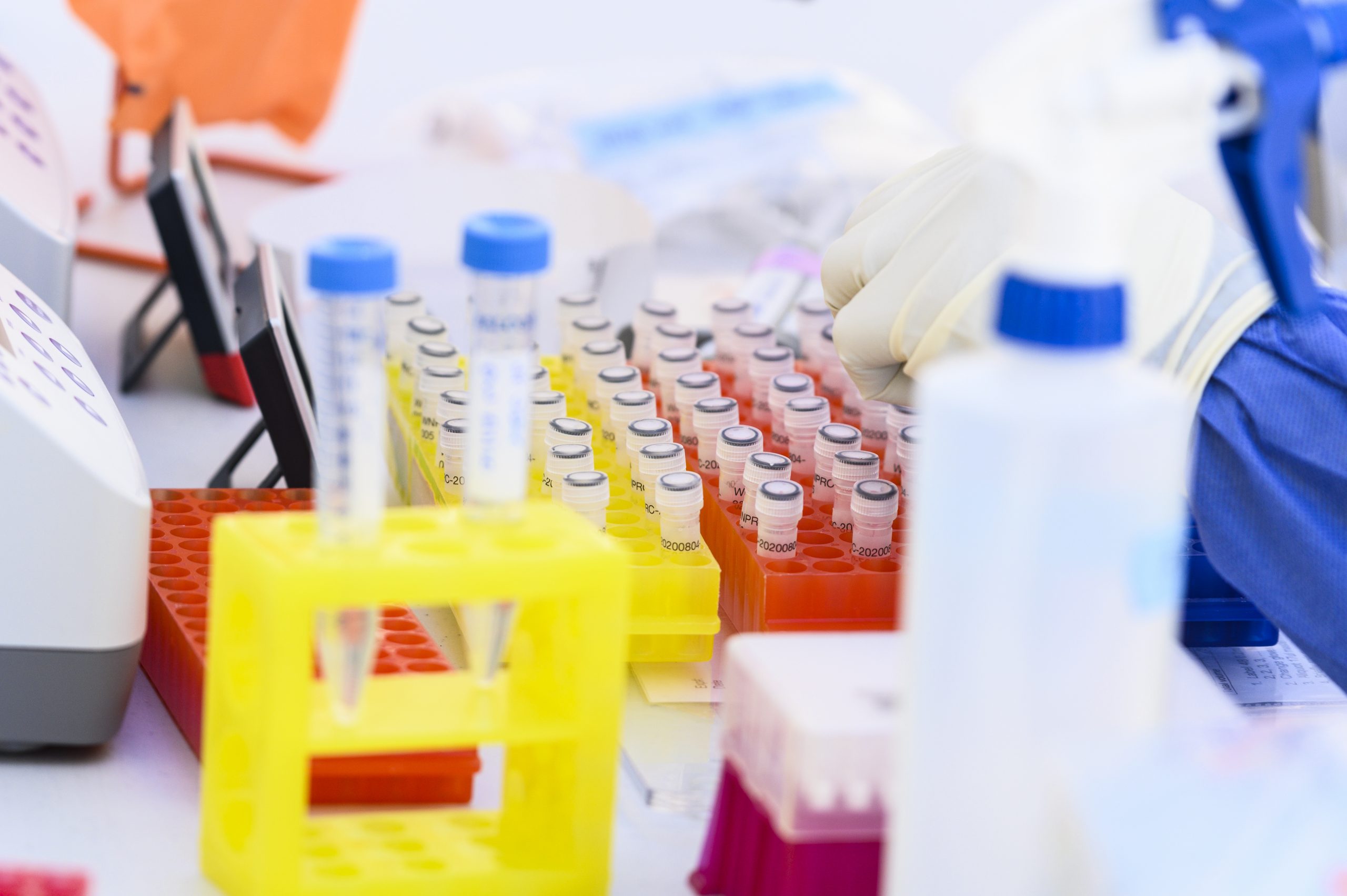 lab bench with plastic tubes